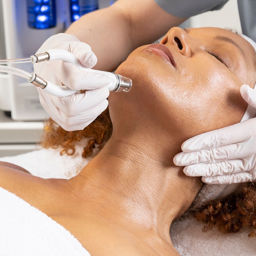DiamondGlow treatment in Spring, TX